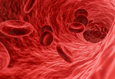 Iron deficiency anemia